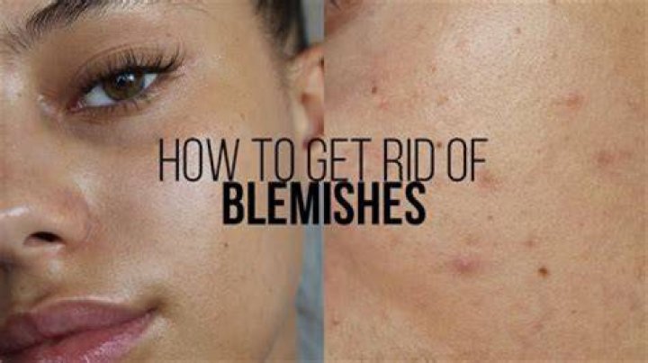 How do you fix blemishes on pictures?