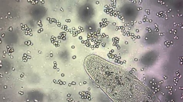 What can I see with 400x microscope?